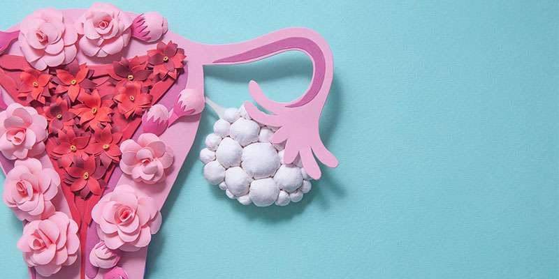 Polikistik Over Sendromu'nda (PCOS) Doğru Bilinen Yanlışlar ve Gerçekler