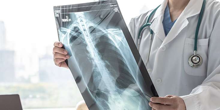 KOAH’a Yol Açan Risk Faktörleri ve KOAH'tan Korunma Yolları